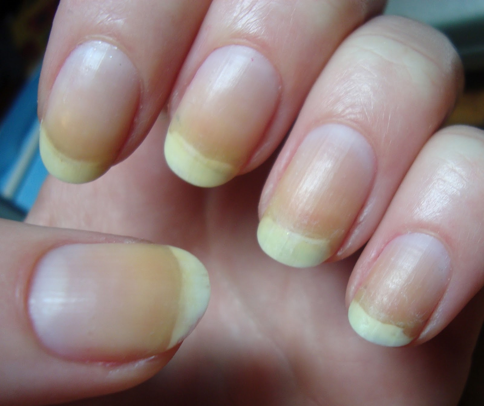 orange fingernails