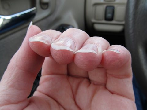 curling nails